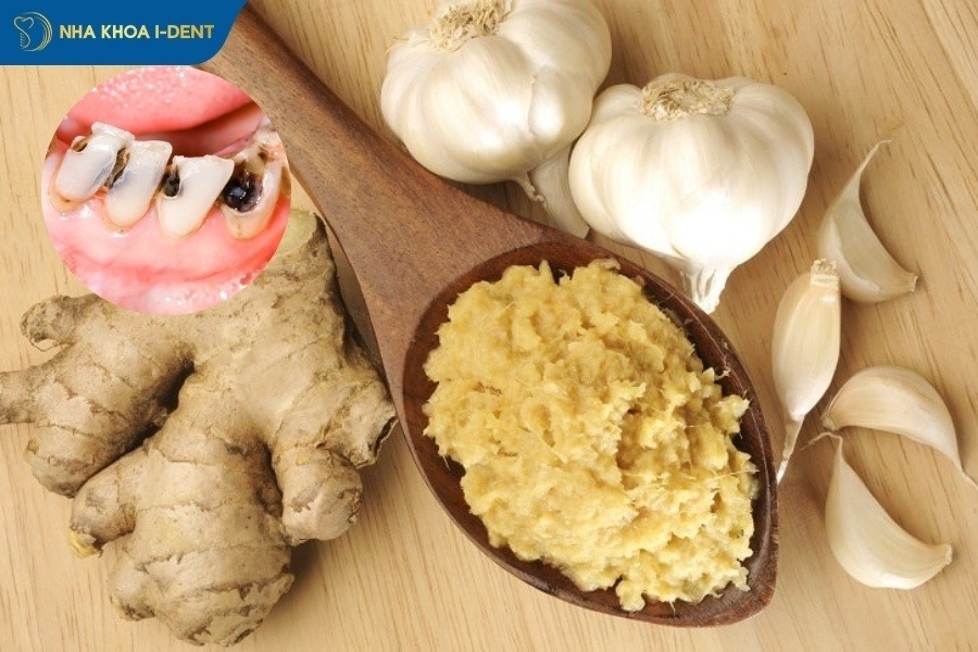 cách trị sâu răng