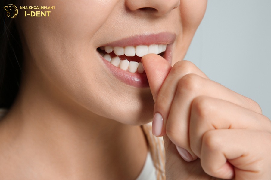 Không cắn móng tay sau khi bọc răng sứ