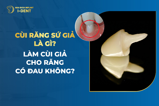 Cùi Răng Sứ Giả Là Gì? Làm Cùi Giả Cho Răng Có Đau Không?