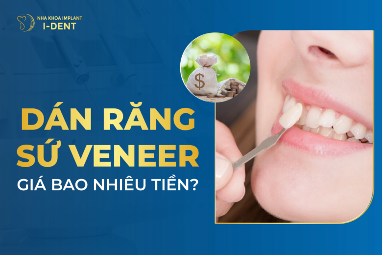 Dán Răng Sứ Veneer Giá Bao Nhiêu Tiền? Bảng Giá 2026