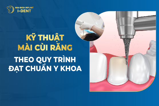 Kỹ Thuật Mài Cùi Răng Theo Quy Trình Đạt Chuẩn Y Khoa