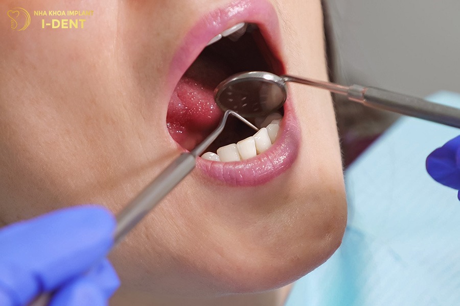 Sau khi bọc răng sứ nên khám nha khoa định kỳ