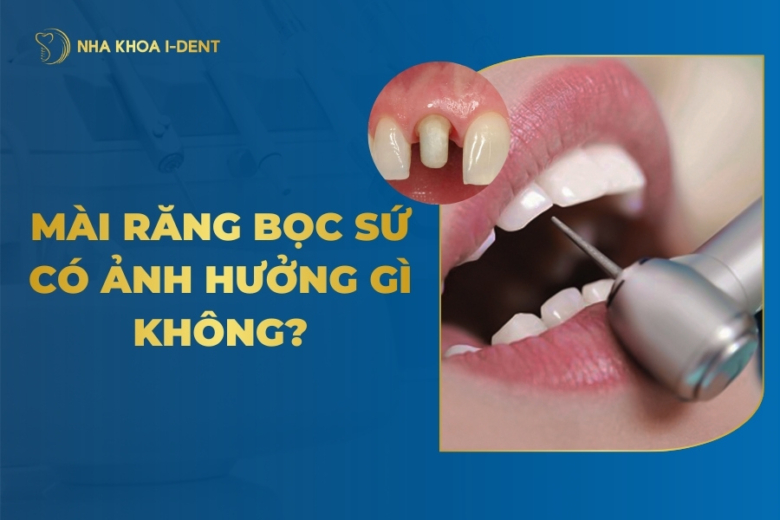 mài răng bọc sứ