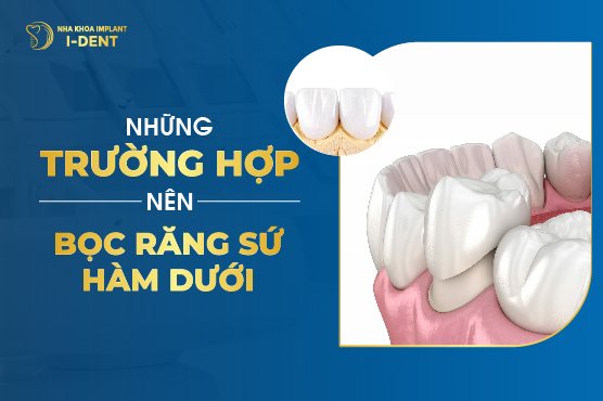 Những Trường Hợp Nên Bọc Răng Sứ Hàm Dưới