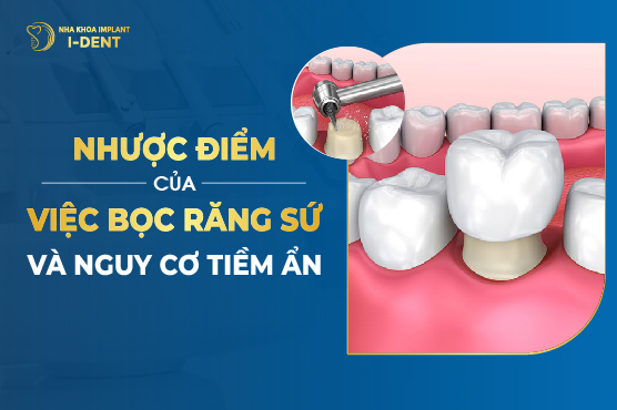 Nhược Điểm Của Bọc Răng Sứ? Có Nguy Cơ Tiềm Ẩn Nào?