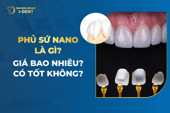 Phủ Sứ Nano Là Gì? Giá Bao Nhiêu? Có Tốt Không?