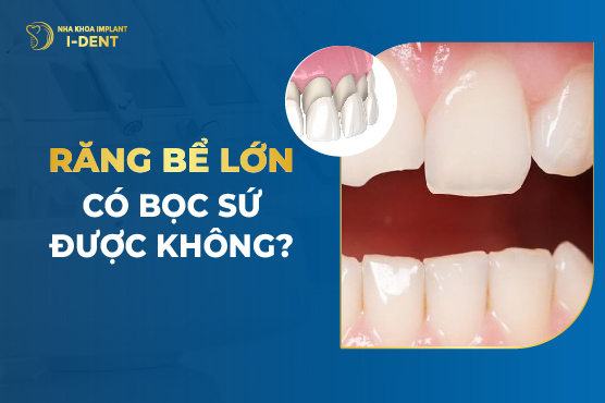 Răng Bể Lớn Có Bọc Sứ Được Không?