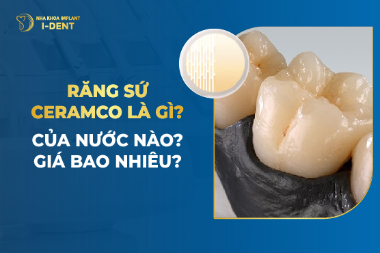 Răng Sứ Ceramco Là Gì? Của Nước Nào? Giá Bao Nhiêu?