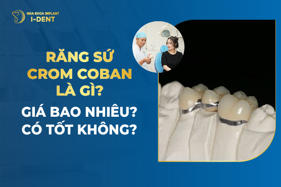 Răng Sứ Crom Coban Là Gì? Giá Bao Nhiêu? Có Tốt Không?