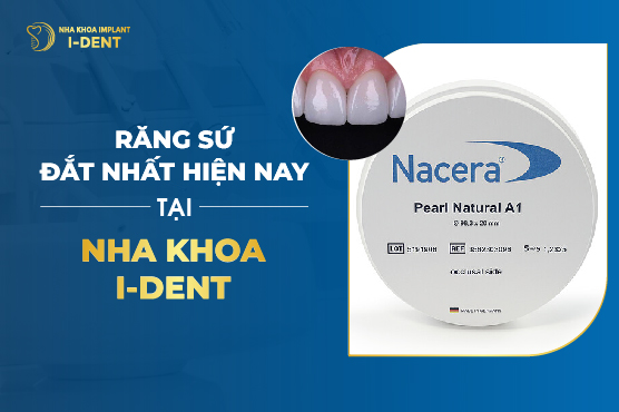 Răng Sứ Đắt Nhất Hiện Nay Tại Nha Khoa I-Dent