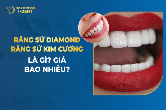 Răng Sứ Diamond/Răng Sứ Kim Cương Là Gì? Giá Bao Nhiêu?