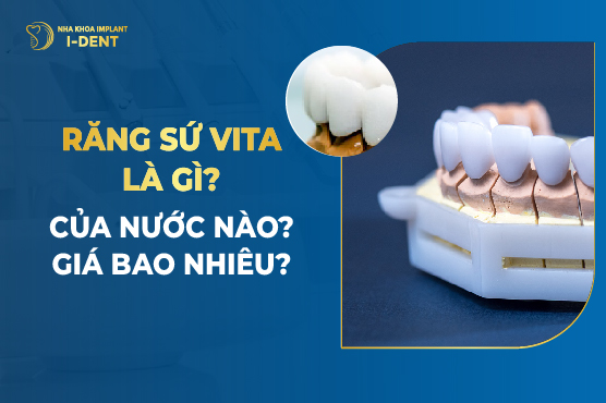 Răng Sứ Vita Là Gì? Của Nước Nào? Giá Bao Nhiêu?