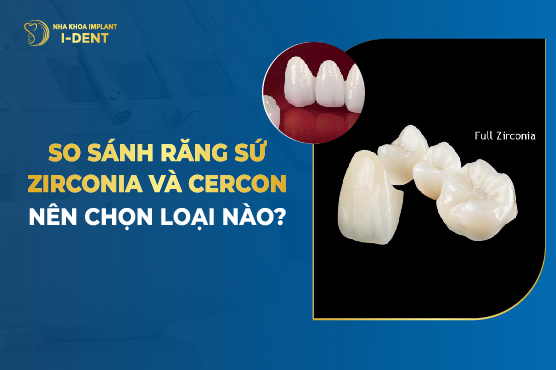 So Sánh Răng Sứ Zirconia Và Cercon – Nên Chọn Loại Nào?