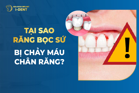 Tại Sao Răng Bọc Sứ Bị Chảy Máu Chân Răng?