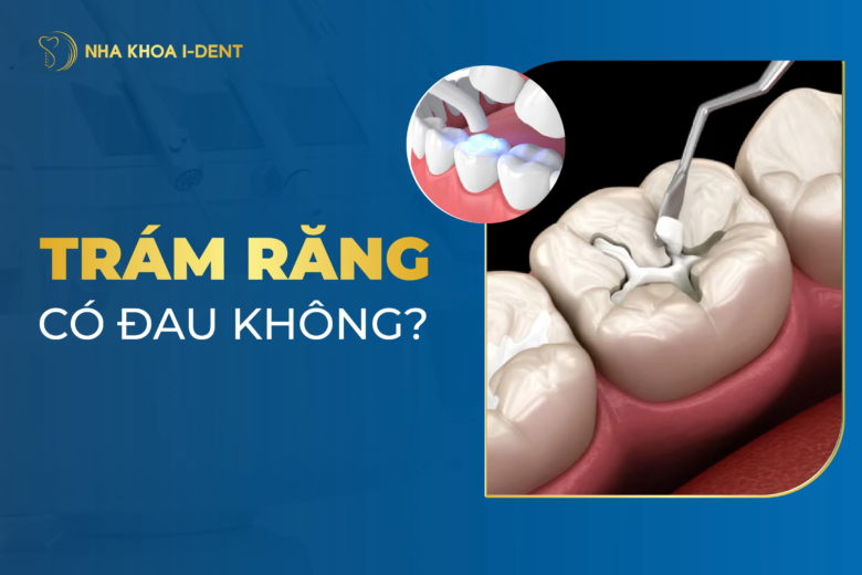 Trám răng có đau không? Các trường hợp nên trám răng