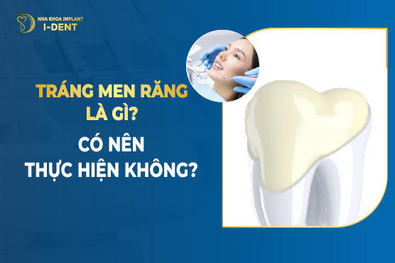 Tráng Men Răng Là Gì? Có Nên Thực Hiện Không?