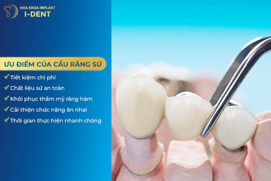 làm cầu răng sứ có tốt không