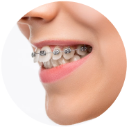 V2 Lay Lai Nu Cuoi Thang Deu