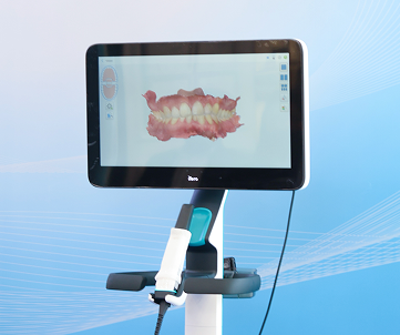 Itero Lumina Next Generation Dental Scanner