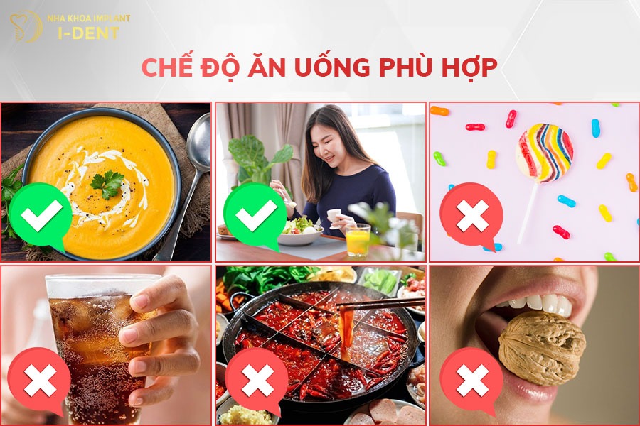 Lựa chọn chế độ ăn uống phù hợp để hạn chế răng sứ bị tổn thương
