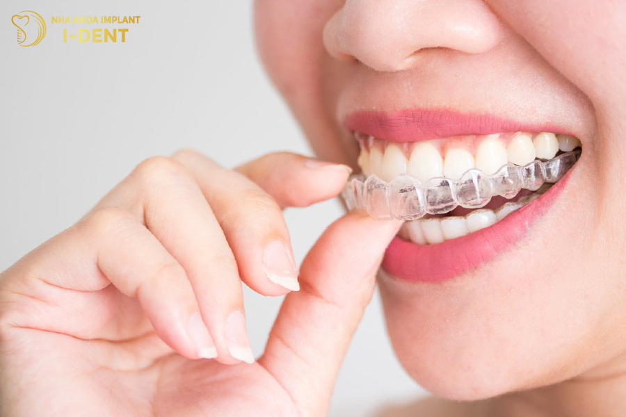 Bộ khay niềng Invisalign 