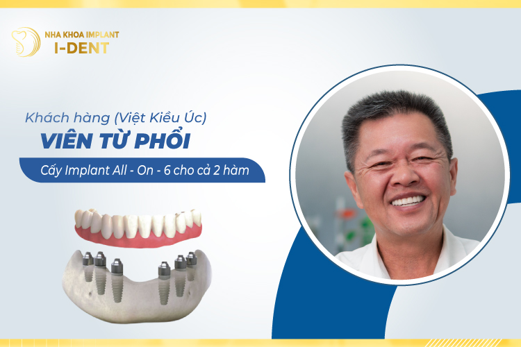 CHÚ VIÊN TỬ PHỐI (VIỆT KIỀU ÚC)