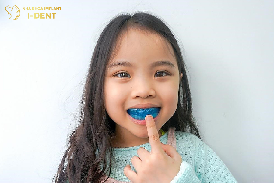 Niềng răng hô cho trẻ em hạn chế được nhiều chi phí phát sinh