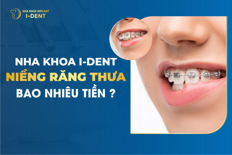 Niềng Răng Thưa Bao Nhiêu Tiền?
