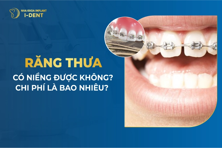 Răng Thưa Có Niềng Được Không? Mất Bao Lâu?