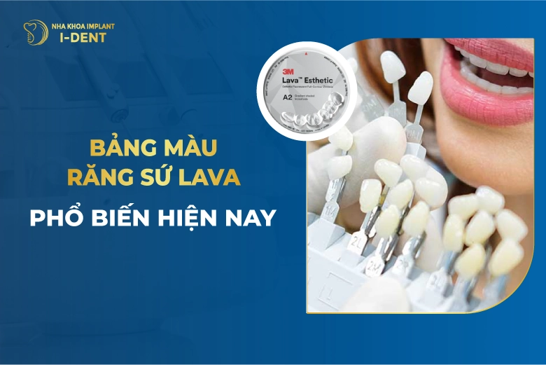 Bảng Màu Răng Sứ Lava gồm bao nhiêu màu?