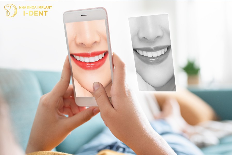 Dùng máy ảnh điện thoại để chụp hình và đánh giá màu răng