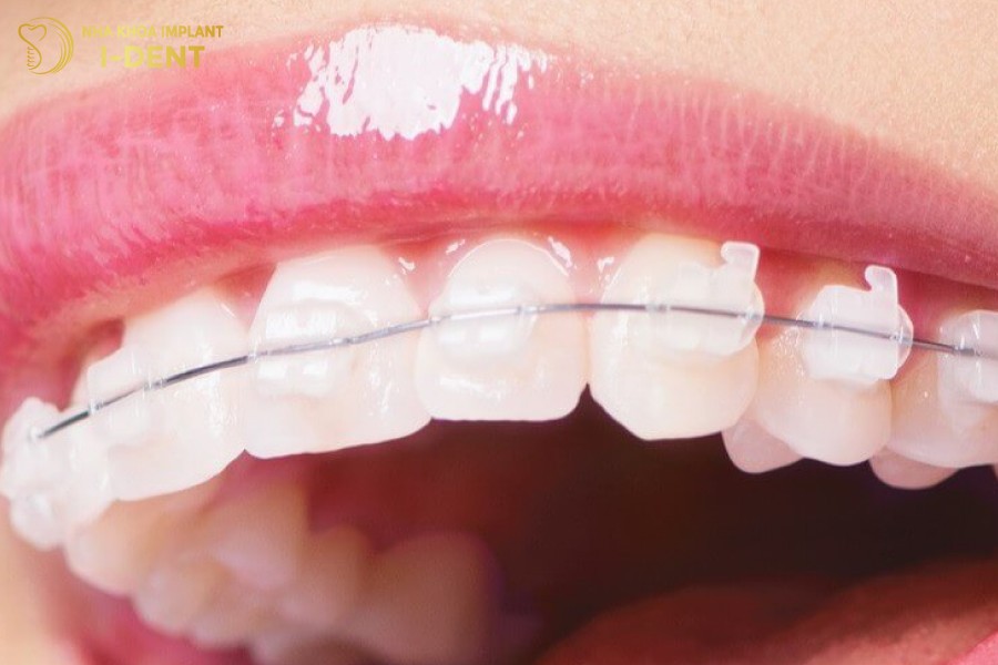 Mac-cai-trong-suot-co-the-bi-vo-khi-bi-va-dap-manh