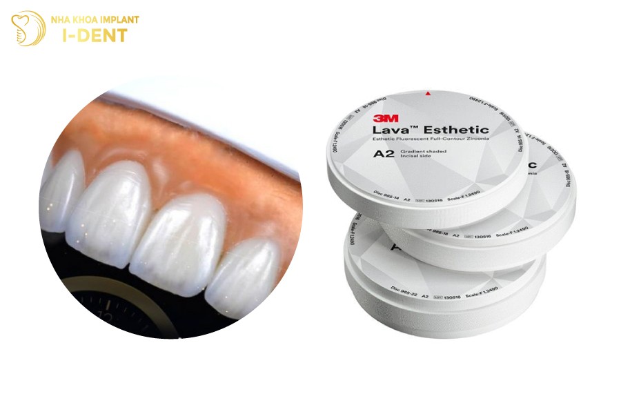 Mau-sac-trang-sang-tu-nhien-cua-su-Lava-Esthetic