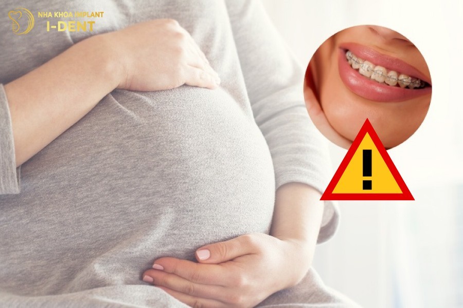 bầu có niềng răng được không