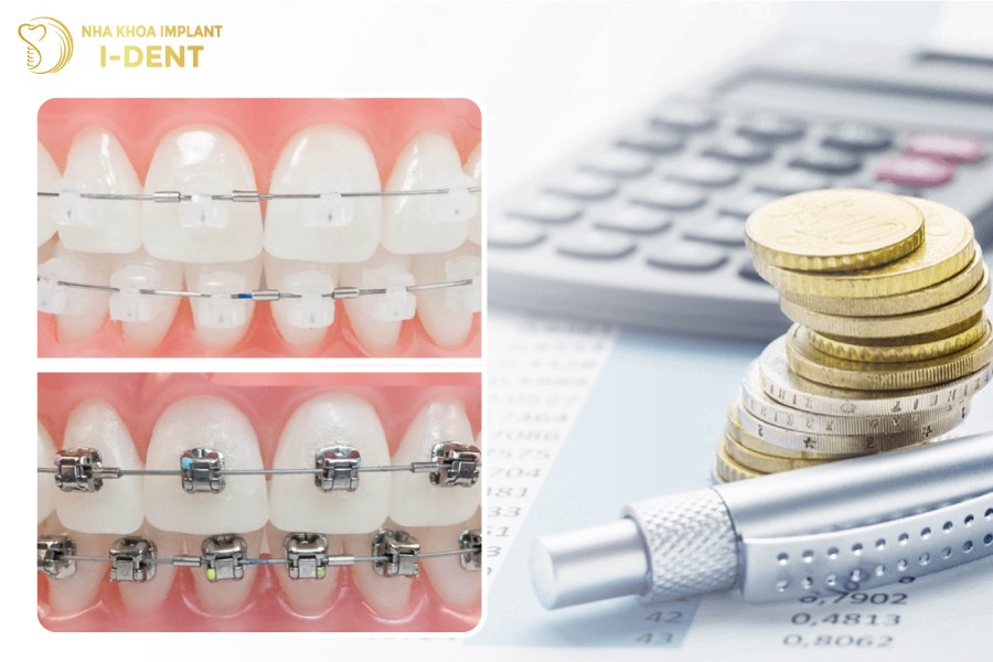 Moi-loai-mac-cai-se-co-chi-phi-khac-nhau