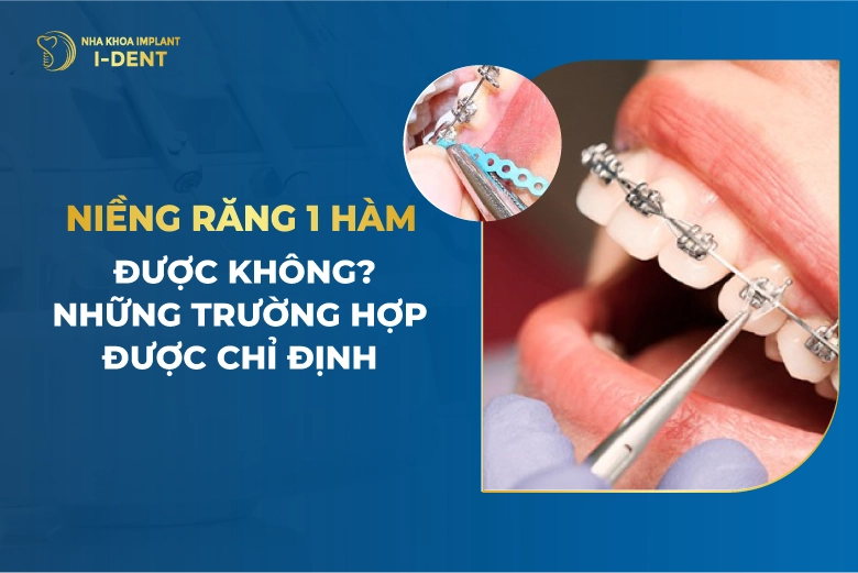 Niềng Răng 1 Hàm Có Được Không?