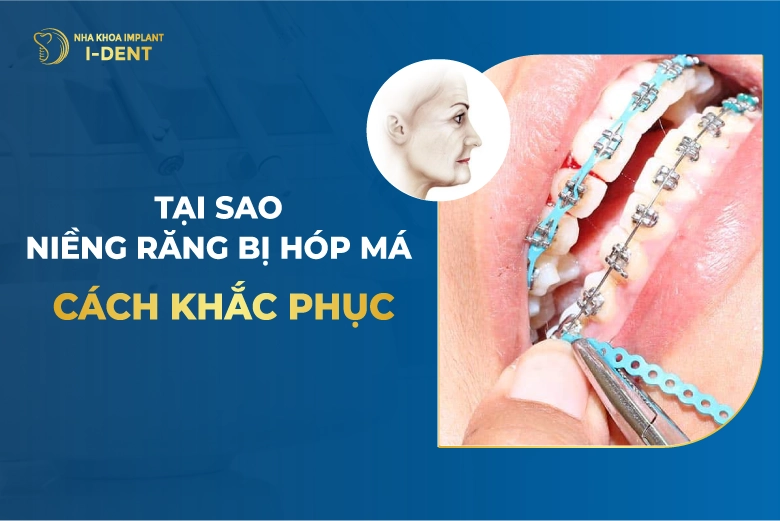 Niềng Răng Bị Hóp Má? Nguyên Nhân Và Cách Khắc Phục