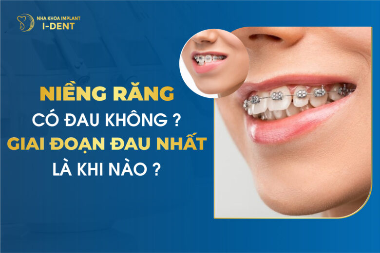 Niềng răng có đau không? 5 giai đoạn đau nhất? Bí quyết giảm đau