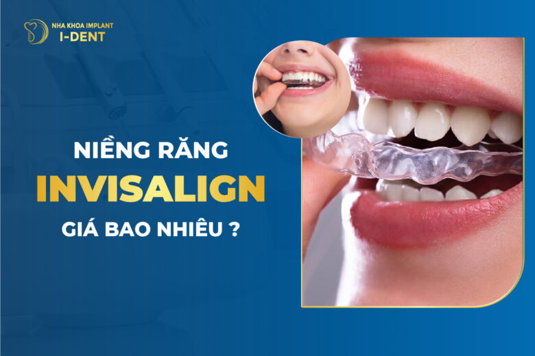 Giá Niềng Răng Invisalign Bao Nhiêu? Chi Phí T2/2026
