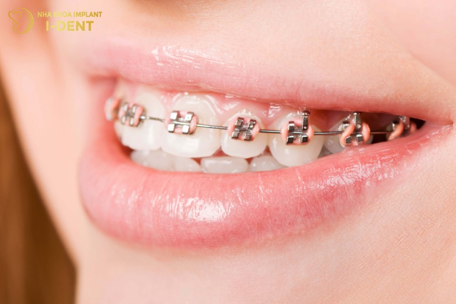 Nieng-rang-1-ham-chi-phu-hop-voi-tinh-trang-khop-can-tuong-doi-chuan