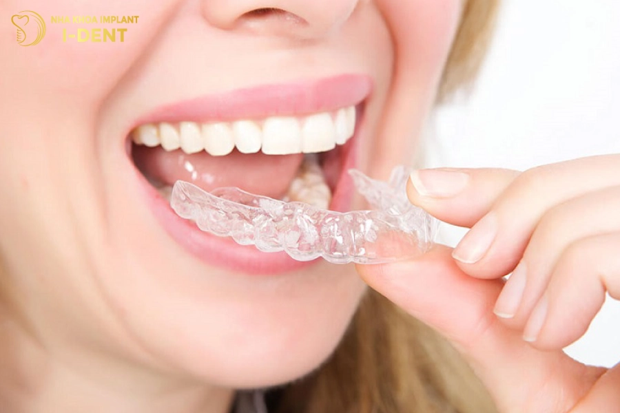Niềng răng Invisalign đảm bảo thẩm mỹ cho người sử dụng