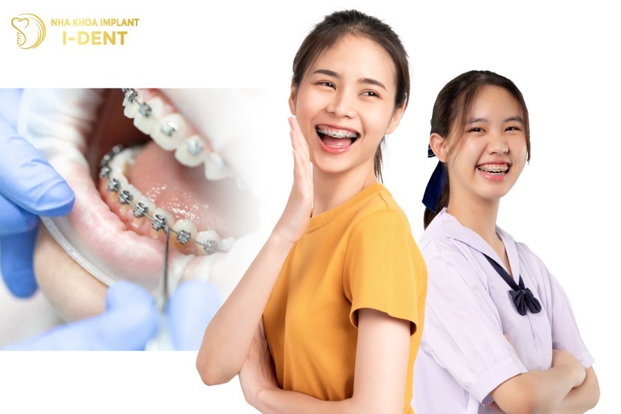 Nieng-rang-mac-cai-kim-loai-thuong-phu-hop-voi-nhieu-doi-tuong