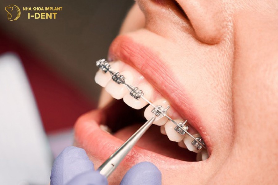 Rang-ho-nhe-co-the-nieng-1-ham