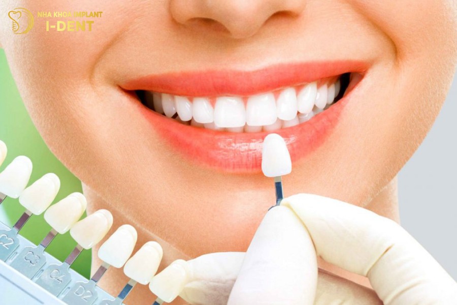 Răng sứ Lava Plus được nghiên cứu và sản xuất bởi tập đoàn 3M.