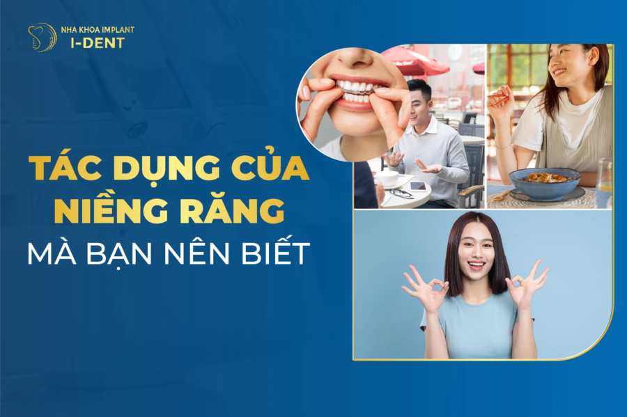 niềng răng có tác dụng gì
