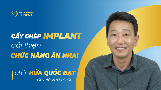 Trồng răng không đau cải thiện ăn nhai | Nha khoa I-DENT