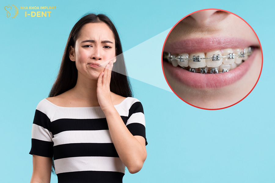 hậu quả của niềng răng