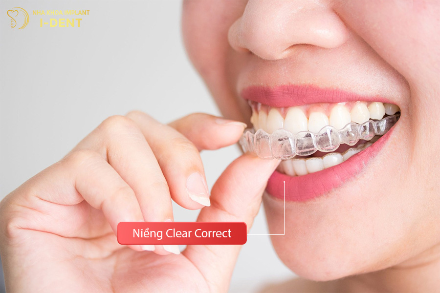 Niềng răng trong suốt Clear Correct