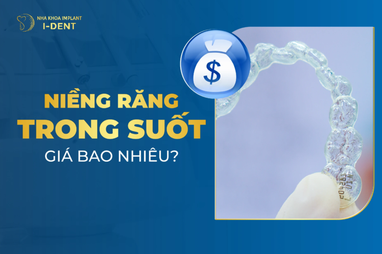 Niềng răng trong suốt giá bao nhiêu? Bảng giá niềng răng trong suốt