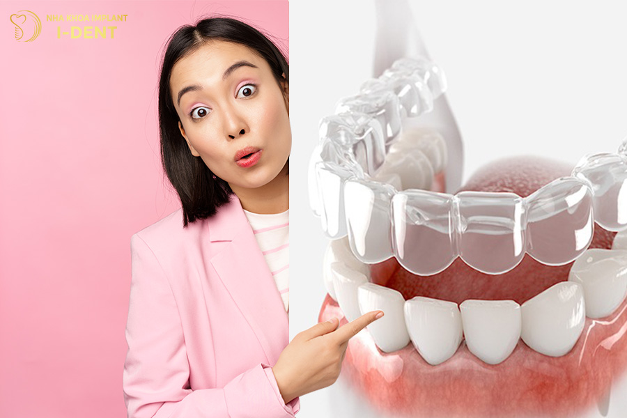 Có nên niềng răng trong suốt giá rẻ